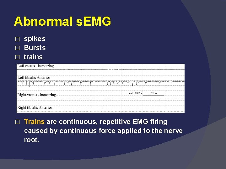 Abnormal s. EMG spikes � Bursts � trains � � Trains are continuous, repetitive