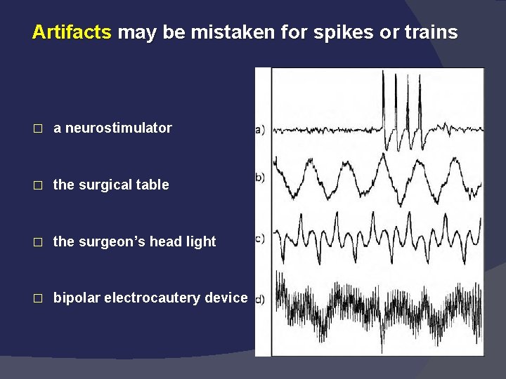 Artifacts may be mistaken for spikes or trains � a neurostimulator � the surgical
