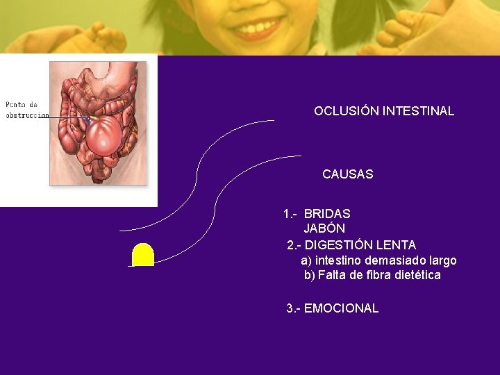 OCLUSIÓN INTESTINAL CAUSAS 1. - BRIDAS JABÓN 2. - DIGESTIÓN LENTA a) intestino demasiado