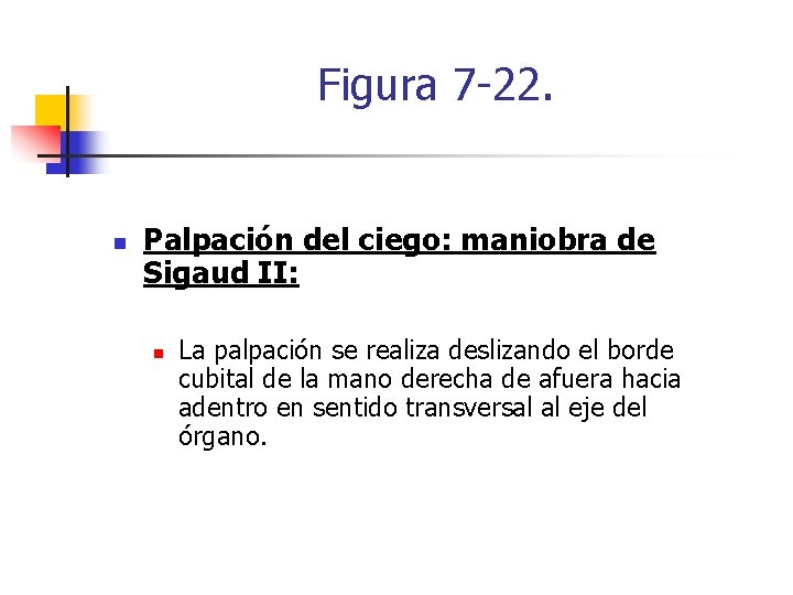 Figura 7 -22. n Palpación del ciego: maniobra de Sigaud II: n La palpación