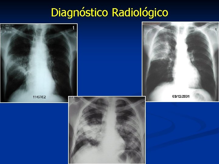 Diagnóstico Radiológico 