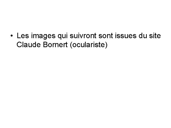 • Les images qui suivront sont issues du site Claude Bornert (oculariste) • Les images qui suivront sont issues du site Claude Bornert (oculariste)