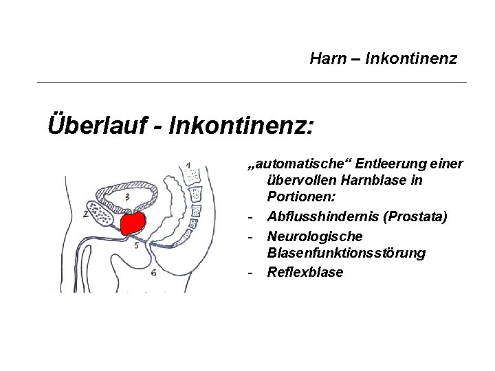 Harn – Inkontinenz Überlauf - Inkontinenz: „automatische“ Entleerung einer übervollen Harnblase in Portionen: -