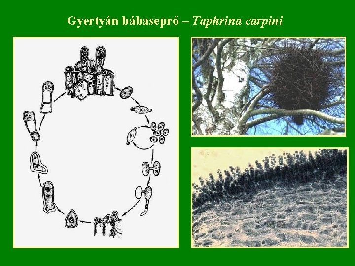 Gyertyán bábaseprő – Taphrina carpini 