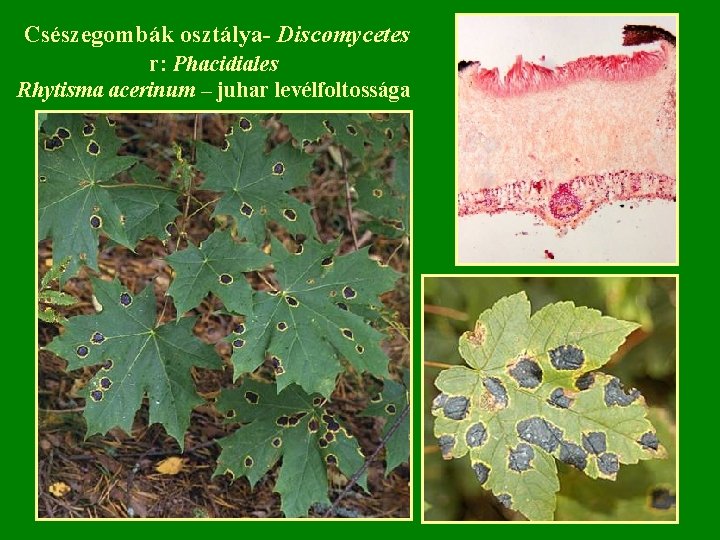 Csészegombák osztálya- Discomycetes r: Phacidiales Rhytisma acerinum – juhar levélfoltossága 