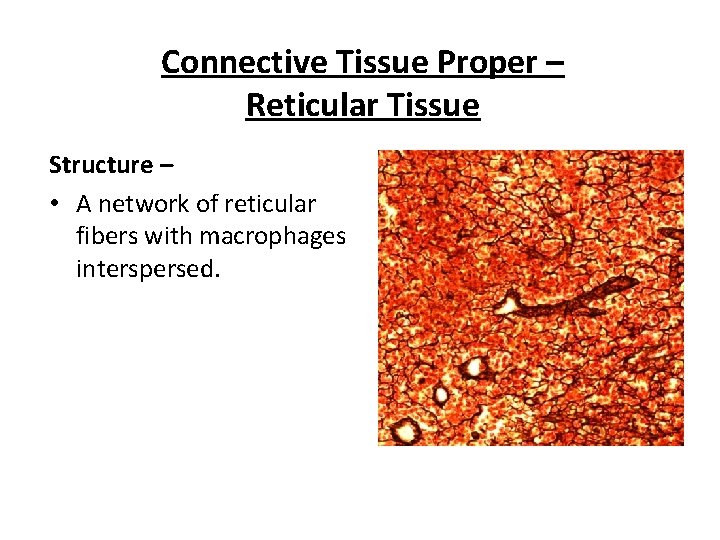 Connective Tissue Proper – Reticular Tissue Structure – • A network of reticular fibers