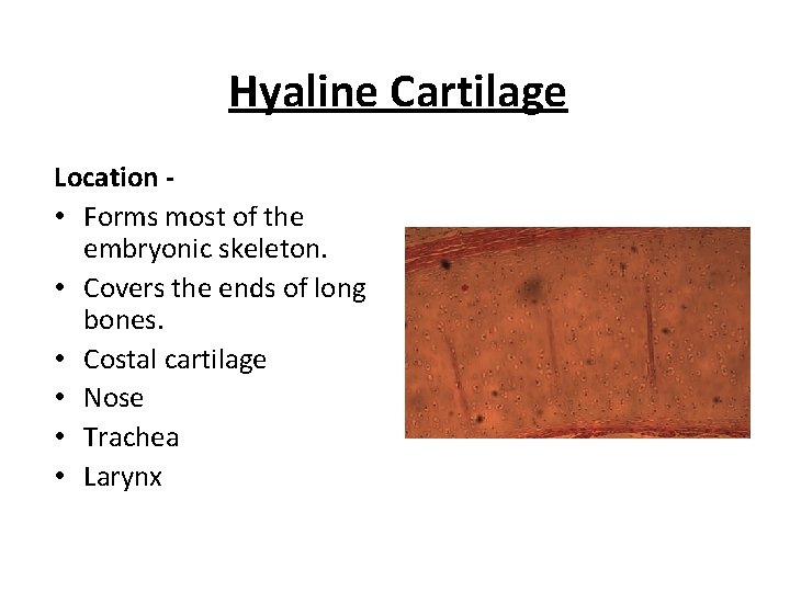 Hyaline Cartilage Location • Forms most of the embryonic skeleton. • Covers the ends