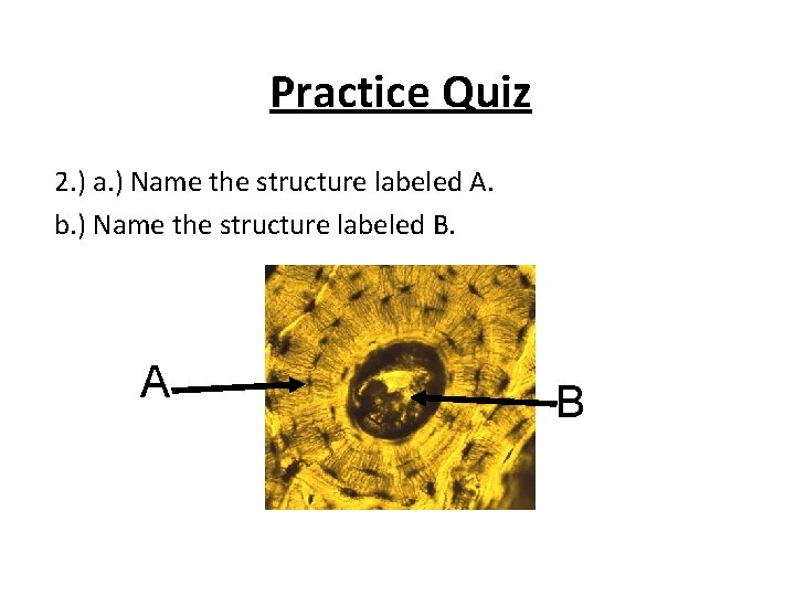 Practice Quiz 2. ) a. ) Name the structure labeled A. b. ) Name