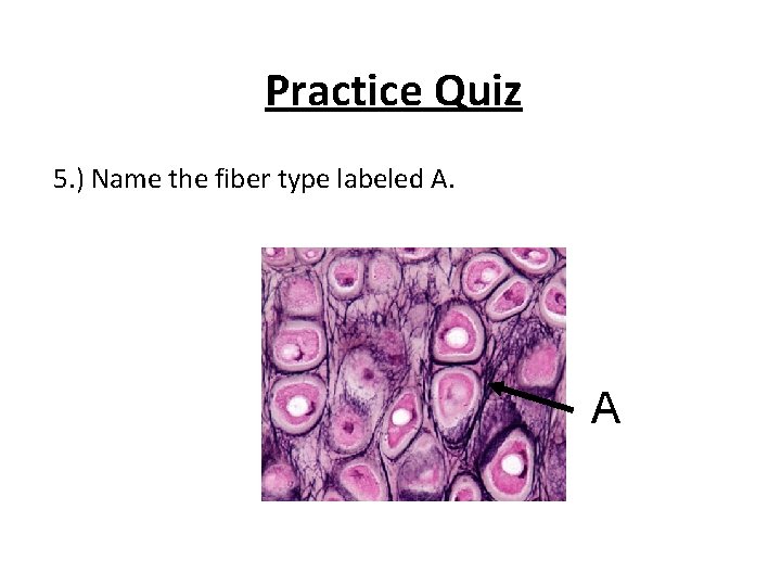 Practice Quiz 5. ) Name the fiber type labeled A. A 