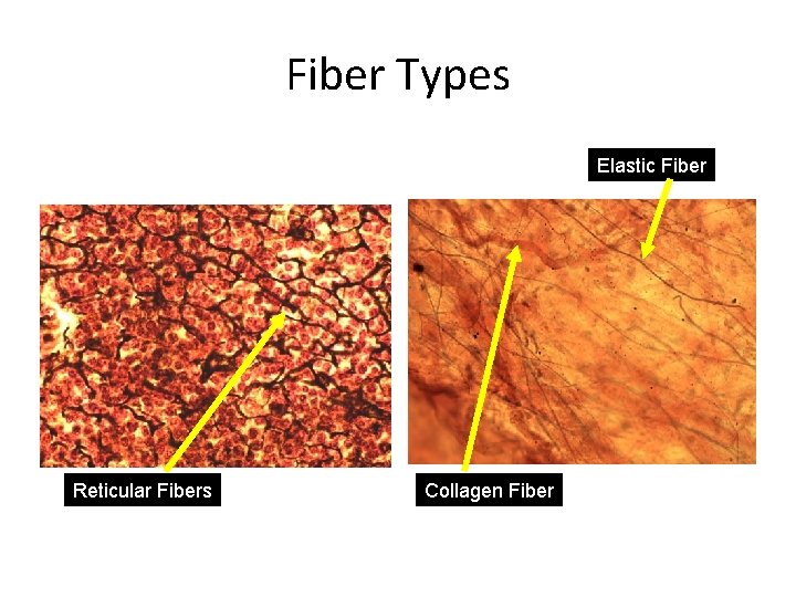 Fiber Types Elastic Fiber Reticular Fibers Collagen Fiber 