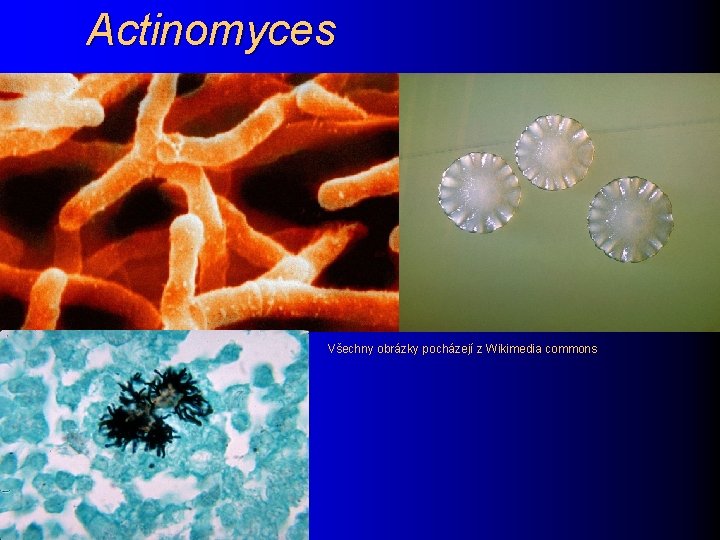 Actinomyces Všechny obrázky pocházejí z Wikimedia commons 