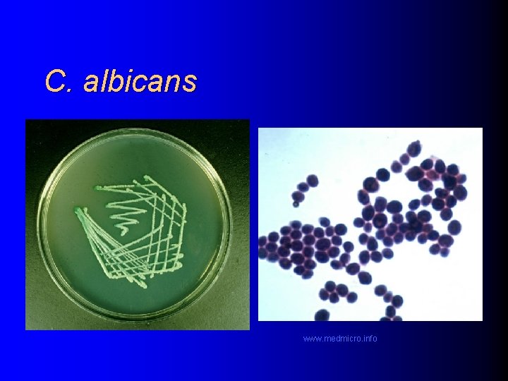 C. albicans www. medmicro. info 