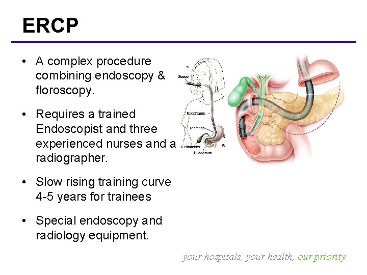 ERCP • A complex procedure combining endoscopy & floroscopy. • Requires a trained Endoscopist