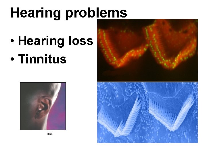 Hearing problems • Hearing loss • Tinnitus HSE 