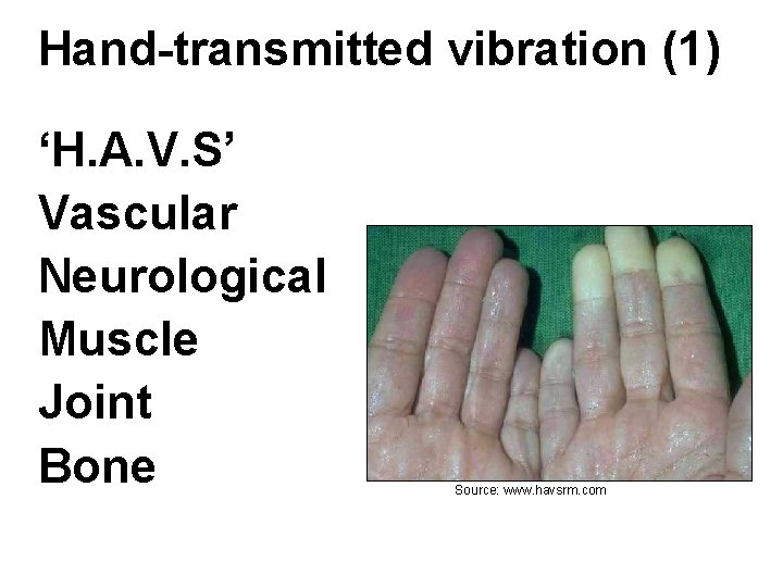 Hand-transmitted vibration (1) ‘H. A. V. S’ Vascular Neurological Muscle Joint Bone Source: www.