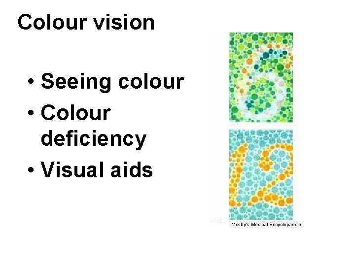 Colour vision • Seeing colour • Colour deficiency • Visual aids Mosby’s Medical Encyclopaedia