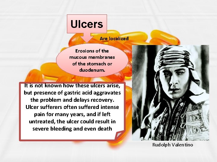 Ulcers Are localized Erosions of the mucous membranes of the stomach or duodenum. It