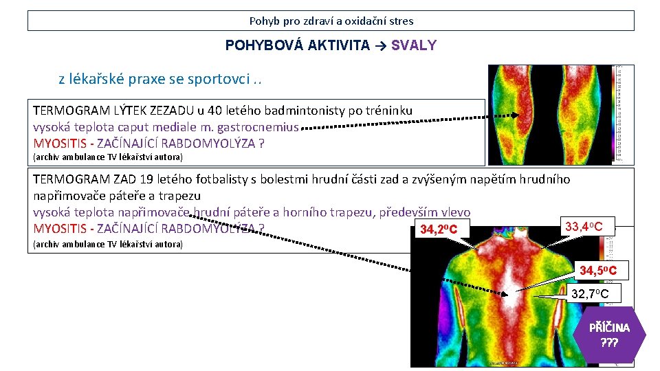 Pohyb pro zdraví a oxidační stres POHYBOVÁ AKTIVITA → SVALY z lékařské praxe se