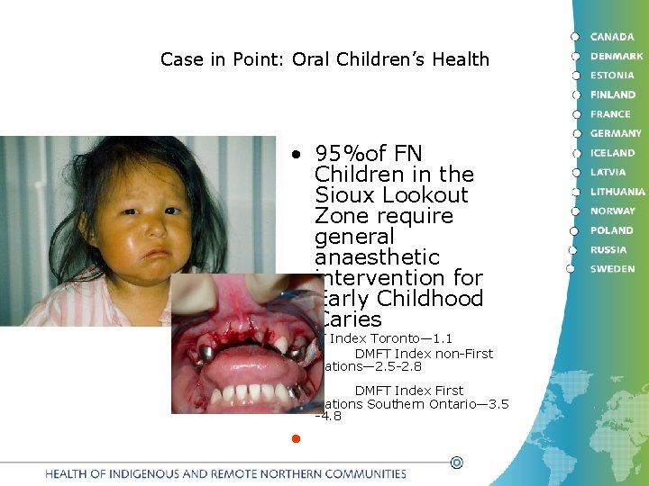 Case in Point: Oral Children’s Health • 95%of FN Children in the Sioux Lookout