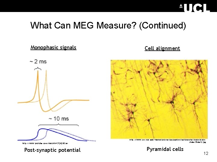 What Can MEG Measure? (Continued) Monophasic signals http: //www. youtube. com/watch? v=CPj 4 j.