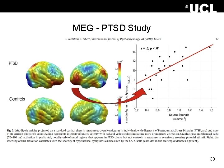 MEG - PTSD Study 33 