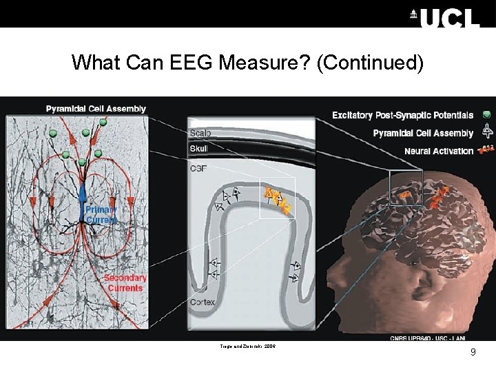 What Can EEG Measure? (Continued) Tiege and Zlobinski, 2006 9 