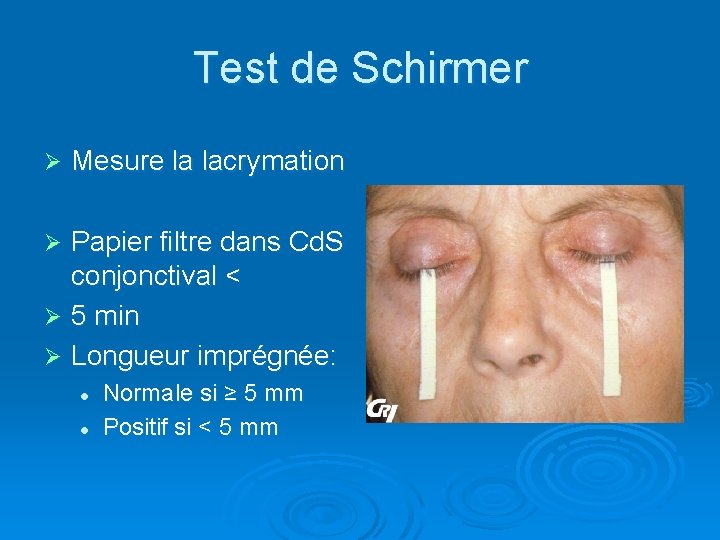 Test de Schirmer Ø Mesure la lacrymation Papier filtre dans Cd. S conjonctival <