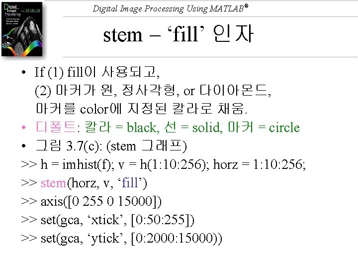 Digital Image Processing Using MATLAB® stem – ‘fill’ 인자 • If (1) fill이 사용되고,