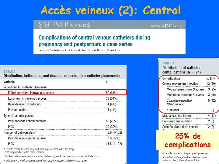 Accès veineux (2): Central 25% de complications 