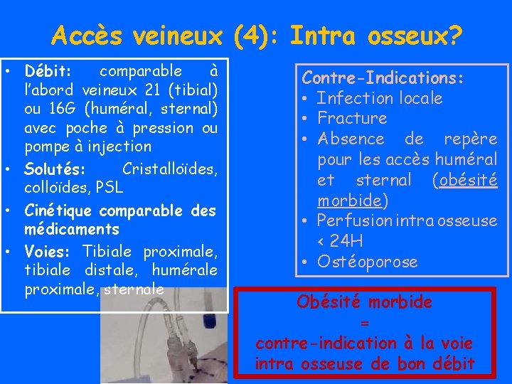 Accès veineux (4): Intra osseux? • Débit: comparable à l’abord veineux 21 (tibial) ou