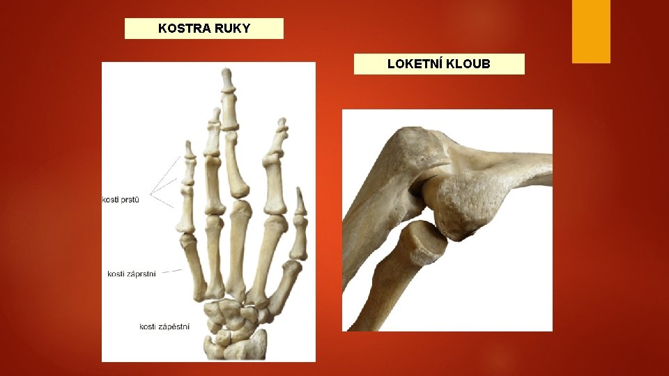  KOSTRA RUKY LOKETNÍ KLOUB 