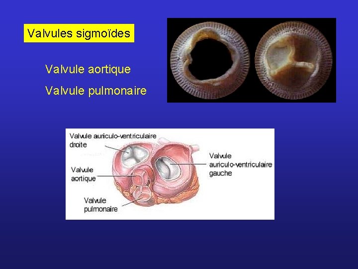 Valvules sigmoïdes Valvule aortique Valvule pulmonaire 