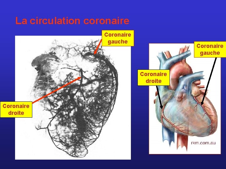 La circulation coronaire Coronaire gauche Coronaire droite 