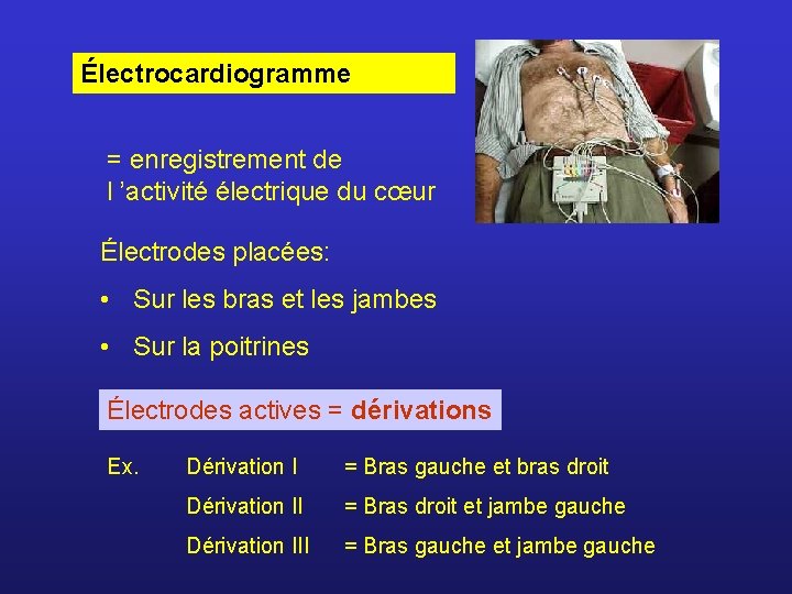 Électrocardiogramme = enregistrement de l ’activité électrique du cœur Électrodes placées: • Sur les