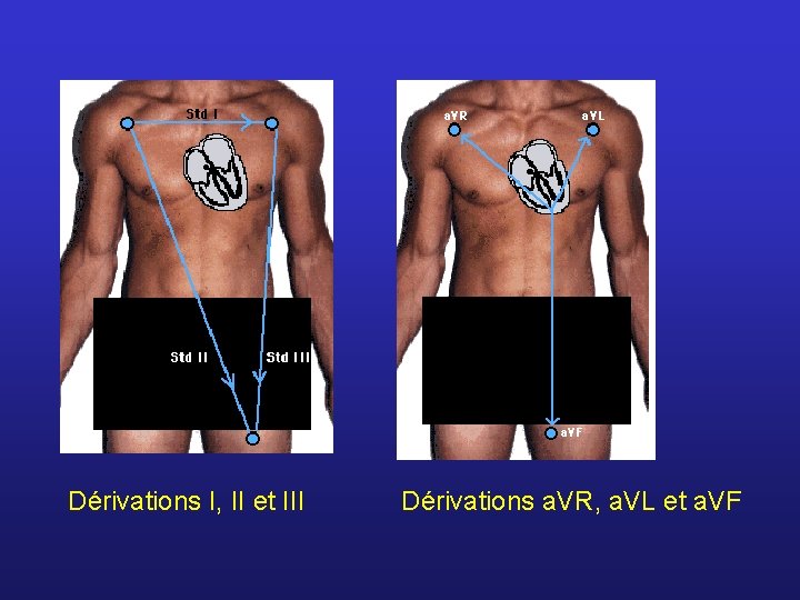 Dérivations I, II et III Dérivations a. VR, a. VL et a. VF 