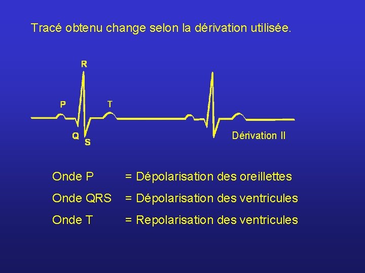 Tracé obtenu change selon la dérivation utilisée. Dérivation II Onde P = Dépolarisation des