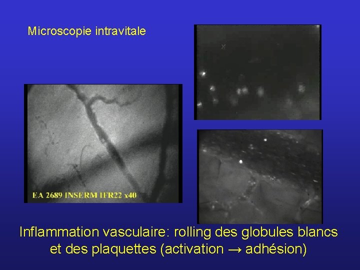 Microscopie intravitale Inflammation vasculaire: rolling des globules blancs et des plaquettes (activation → adhésion)