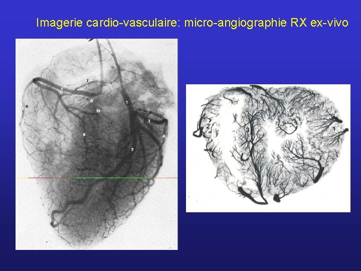 Imagerie cardio-vasculaire: micro-angiographie RX ex-vivo 