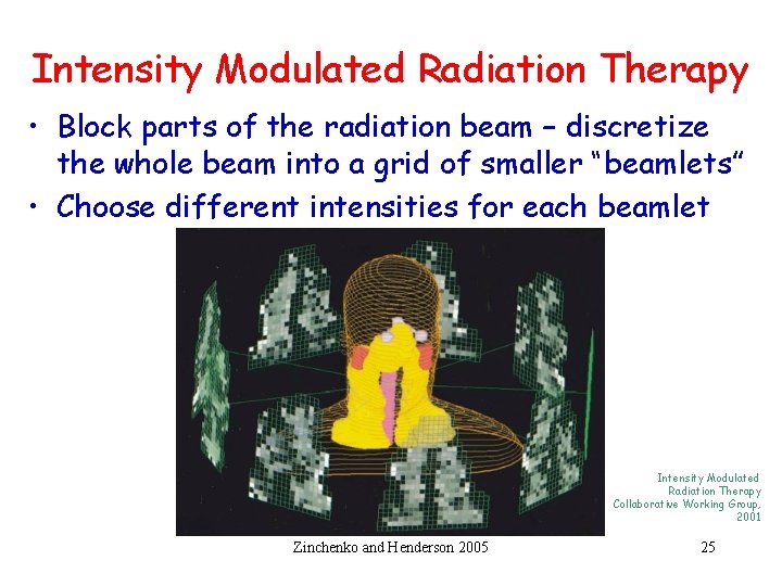 Intensity Modulated Radiation Therapy • Block parts of the radiation beam – discretize the