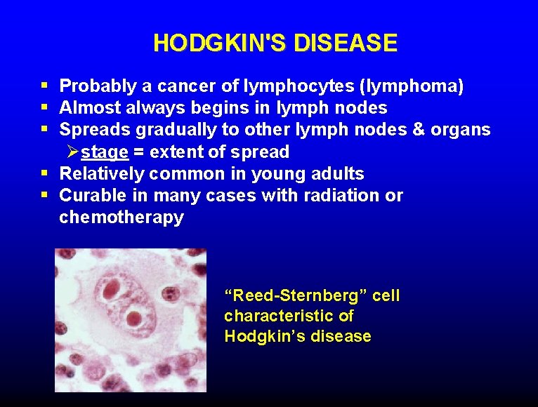 HODGKIN'S DISEASE § Probably a cancer of lymphocytes (lymphoma) § Almost always begins in