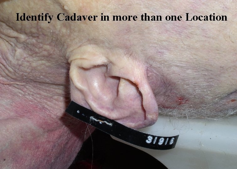Identify Cadaver in more than one Location 