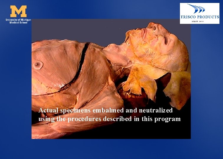 Actual specimens embalmed and neutralized using the procedures described in this program 