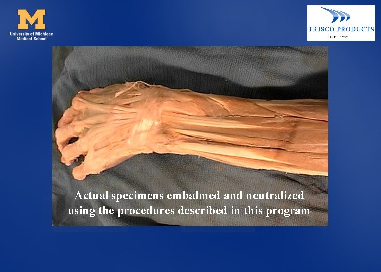 Actual specimens embalmed and neutralized using the procedures described in this program 