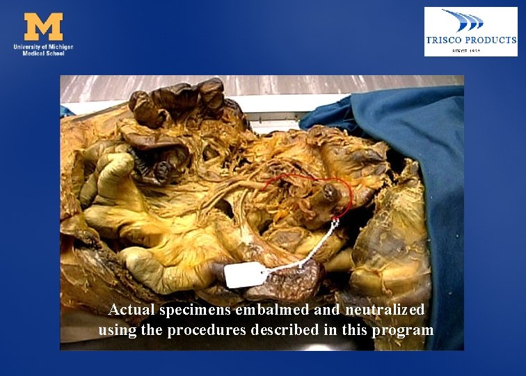 Actual specimens embalmed and neutralized using the procedures described in this program 