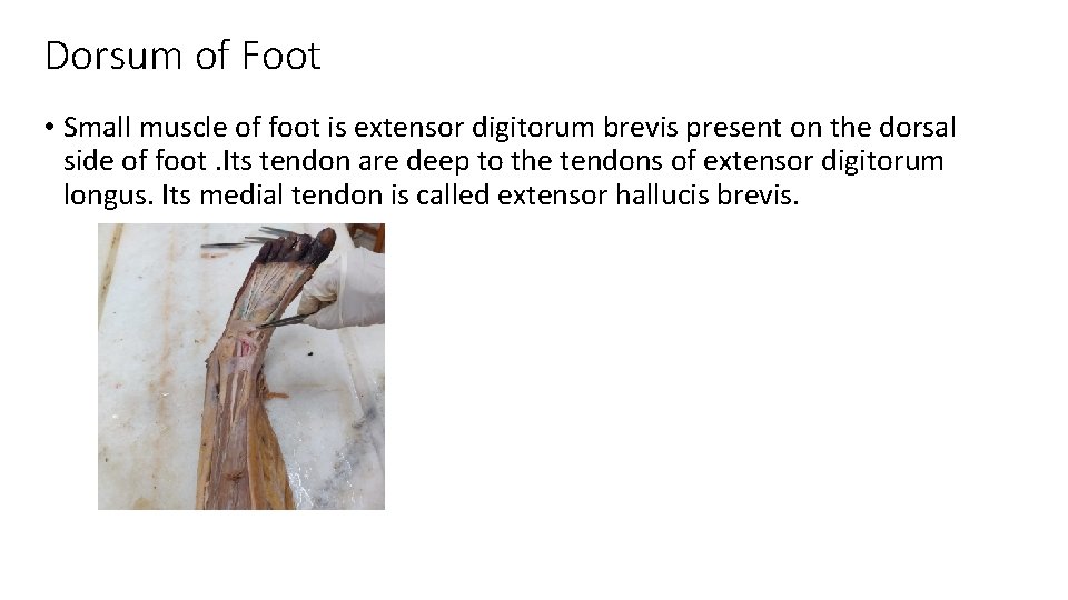 Dorsum of Foot • Small muscle of foot is extensor digitorum brevis present on