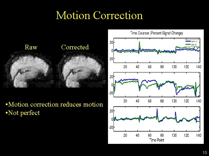 Motion Correction Raw Corrected • Motion correction reduces motion • Not perfect 10 