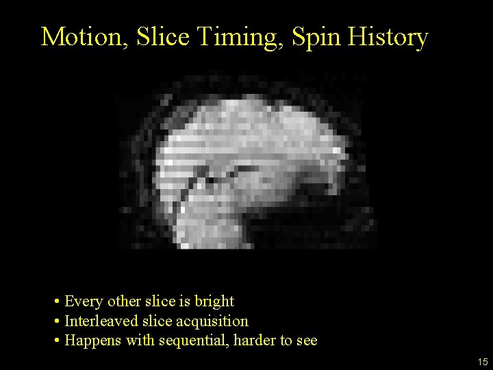 Motion, Slice Timing, Spin History • Every other slice is bright • Interleaved slice