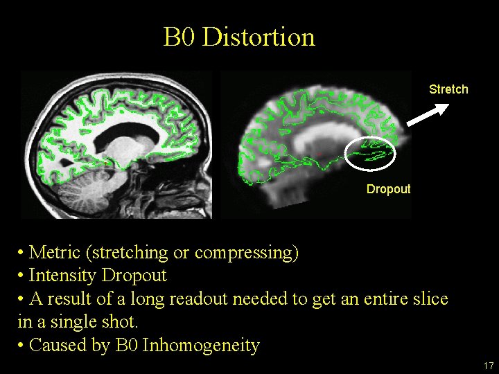 B 0 Distortion Stretch Dropout • Metric (stretching or compressing) • Intensity Dropout •