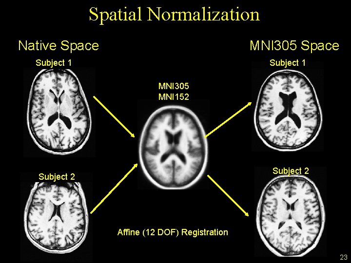 Spatial Normalization Native Space MNI 305 Space Subject 1 MNI 305 MNI 152 Subject