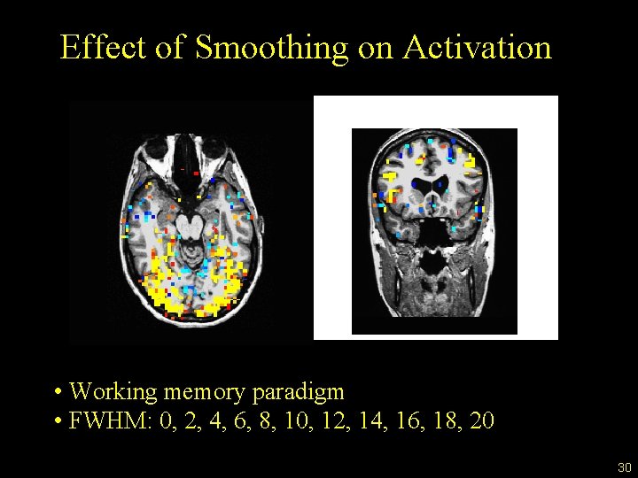 Effect of Smoothing on Activation • Working memory paradigm • FWHM: 0, 2, 4,
